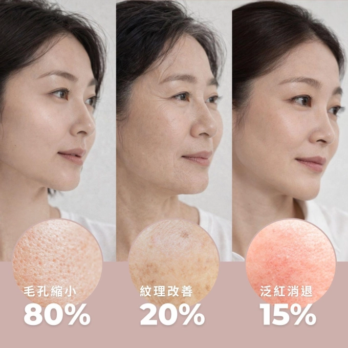 有肌泌語iPSC超泌體再生精華3日組 縮圖 5